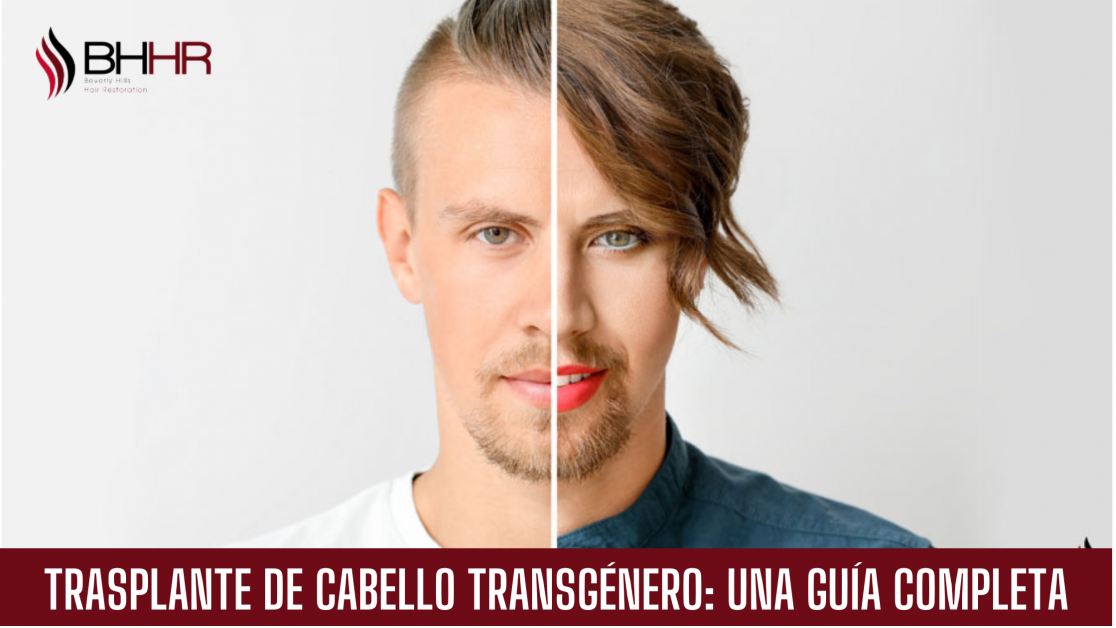 trasplante de cabello transgénero